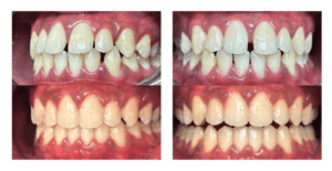 Before & After: Be Inspired by Real Patient Results.