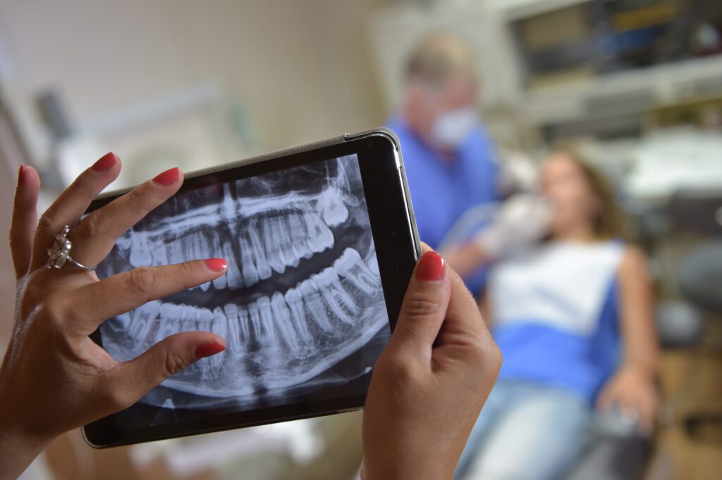 Tooth Extractions in Dallas TX